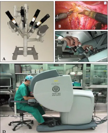 Fig. 1. Robotic cart with telerobotic arms (da Vinci surgical system); (A) da Vinci robot cart with 4 robotic arms (B) Surgical field; (C and D) Surgeon console