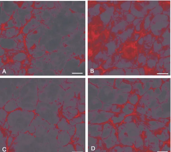 Fig. 3. Comparative fluorescent micrographs showing IGF-1 inhibition of TGF- -mediated fibronectin accumulation in β HLE B-3 cells