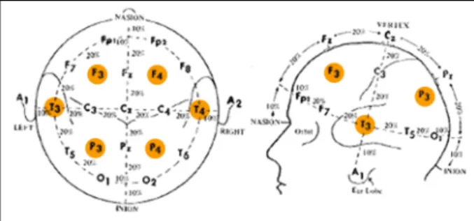 Figure 1. Electrode placement