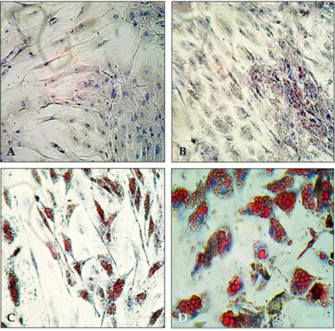 Fig. 1. Oil Red O staining of SGBS cells at (A) Day 0 and at (B) Day 4, (C) Day 10, and (D) Day 20 after differentiation