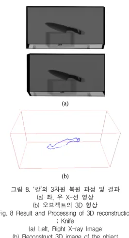 Fig.  7  Result  and  Processing  of  3D  reconstruction  ;  Key (a)  Left  &amp;  Right  X-ray  Image  (b)  Right  edge  image 