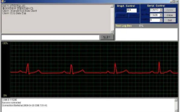 그림 11. 서버 시스템에서의 ECG Data 수신 Fig. 11 Receiving ECG Data at Server Interface