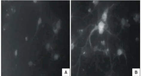 Fig.  1.  More  increased  substance  P  expression  in  rat  cortical  cells  after  hypoxia  (B)  than  before  hypoxia  (A)  (×400).