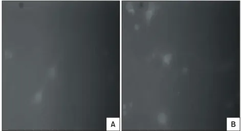 Fig.  2.  More  increased  kainate  expression  in  rat  cortical  cells  after  hypoxia  (B)  than  before  hypoxia  (A)  (×400).