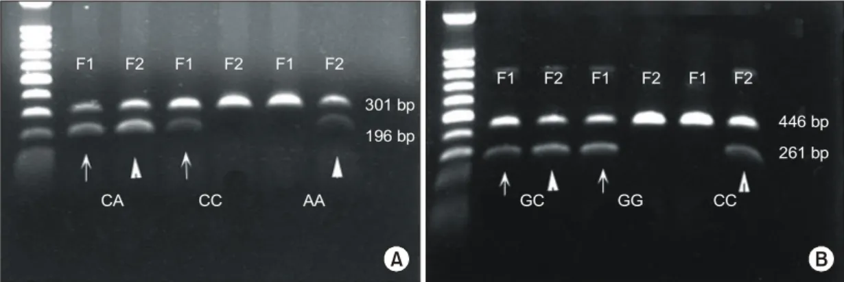 Fig.  1.  Electrophoresis  of  the  PCR  products  of  IL-18  gene  polymorphisms.  (A)  C/A  polymorphism  at  position  -607