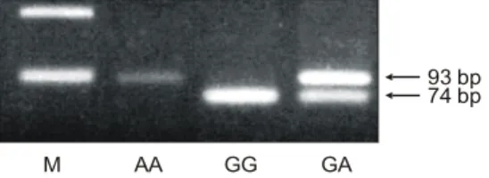 Fig.  1.  G/A  polymorphism  at  position  2964  in  the  3'  Un- Un-translated  Region  of  STAT6  by  PCR-RFLP   analy-sis