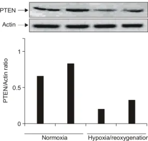 Fig.  1. PTEN  expression  in  the  synovial  fibroblasts. 