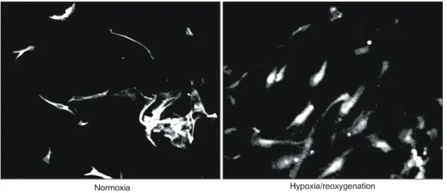 Fig.  4.  PIP3  expression  after  stimulation  with  hypoxia/  reoxygenation.  The  expression  of  PIP3  in  the  rheumatoid  synovial  fibroblasts  was  examined  by  immunocytochemical  stain