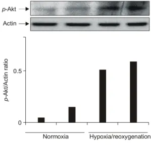 Fig.  5.  p-Akt  expression  after  stimulation  with  hypoxia/ 