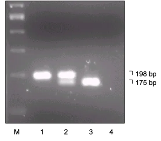 Fig.  1.  A  polymerase  chain  reaction  (PCR)  assay  to  detect  C/T  polymorphism  at  codon  677  in  the  MTHFR  gene