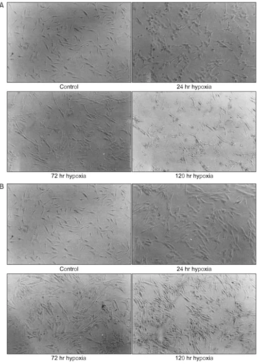 Fig.  1.  Morphologic  changes  of  fibroblast-like  synoviocytes  in  hypoxic  condition
