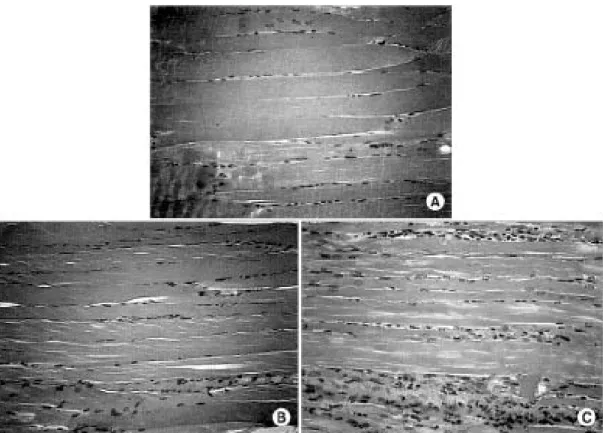 Fig.  2.  The  histopathologic  semi-quantitative  grading  of  severity  in  muscle  biopsy  of  inflammatory  myopathies