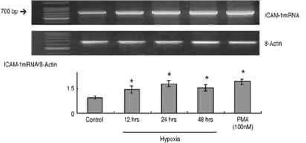 Fig. 2. ICAM-1 mRNA expression in synovial fibroblasts exposed to hypoxic condition (＜3% O 2 ) for 12, 24, 48 hours, as determined by RT-PCR analysis