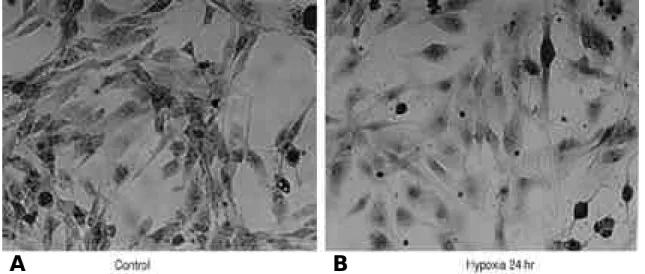 Fig. 6. Lymphocyte adhesion assay. The fluorescent intensity of adherent lymphocytes was measured by fluorescent plate reader