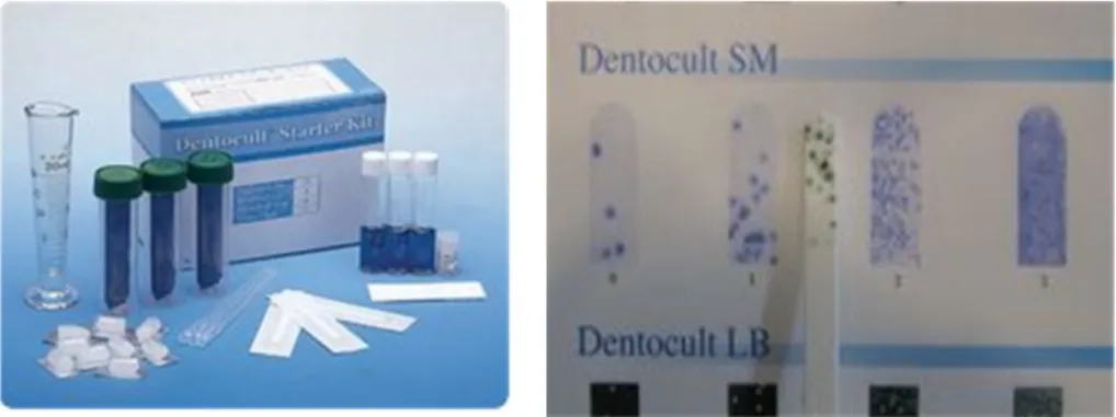 Table 1. Decision of dentocult SM 