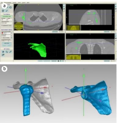 Figure 2. (a) The segmentation of the shoulder joint using the ITK- ITK-Snap. (b) 3D model of the humerus and the scapula