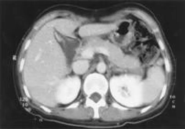Fig. 2. Note brown discoloration due to bile stasis in the hepatic parenchymal cells around the terminal hepatic vein (×100, H&amp;E stain).