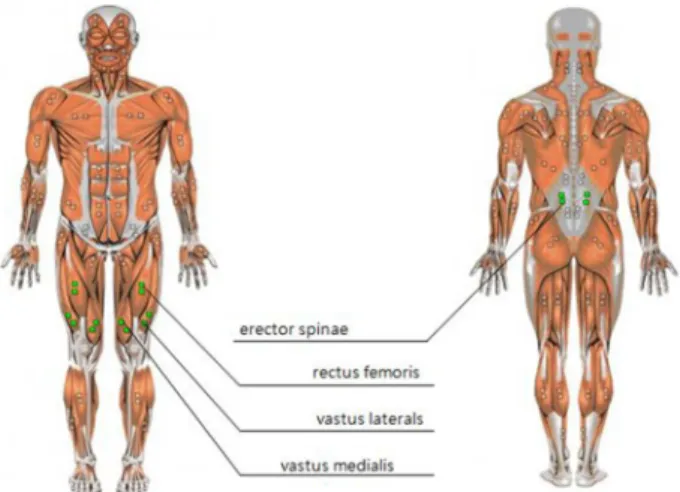 Figure 2. Surface electrode 