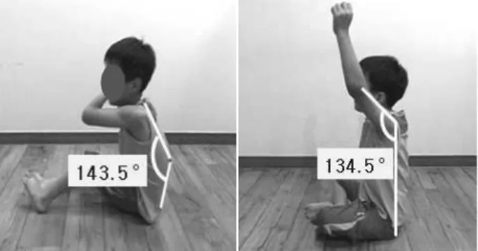 Figure 1. Definition of vertebral &amp; shoulder joint angle