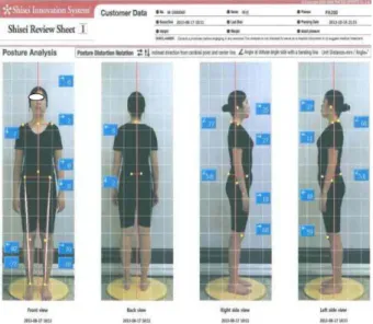 Figure 7. Feet balance image before and after the program participation