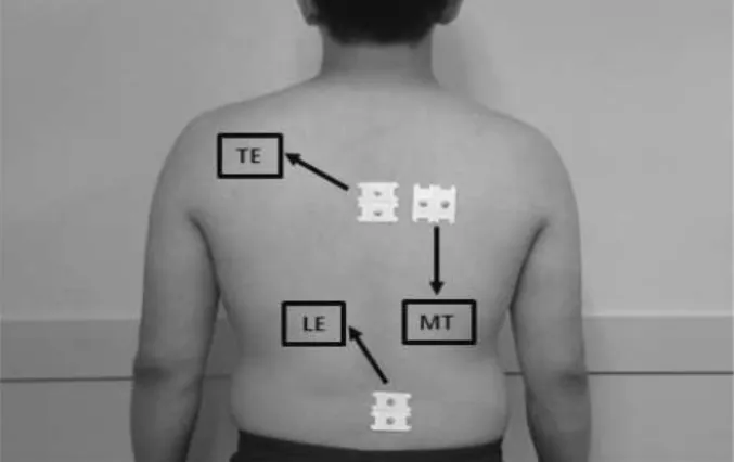 Figure 1. Attachment sites of surface EMG electrodes for back muscles (TE: