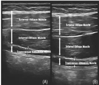 Figure 2. Transversus abdominis ultrasound image (A. Resting, B. Active)