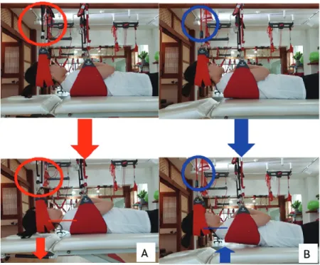 Fig.  2.  Open  kinetic  chain  (A)  and  closed  kinetic  chain  (B).