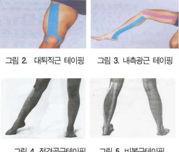 그림 4.  전경골근테이핑       그림  5.  비복근테이핑 그림 2.    대퇴직근 테이핑       그림 3.  내측광근  테이핑      그림  6