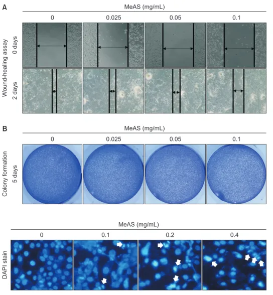Fig. 3.  Observation of nuclear change by  methanol extracts of Asarum sieboldii (MeAS)  in FaDu cells