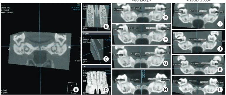 Fig. 2. Process for standardization of the reference plane (A) for measuring alveolar bone height in micro-computed tomographyimaging (A–D)