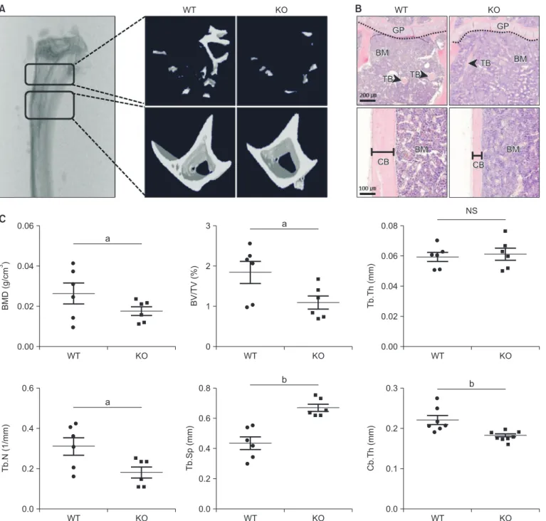 Fig. 2.  CCR5 deficiency decreases trabecular bone mass and cortical bone thickness in the tibium of 12 month-old mice