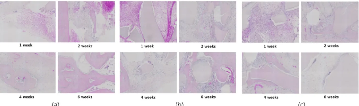 Fig. 6. Masson’s trichrome staining analysis. (a) control group that the bone defect was not treated with anything, (b) experimental  group A that autogenous demineralized dentin matrix was grafted into the bone defect, (c) experimental group B that autoge