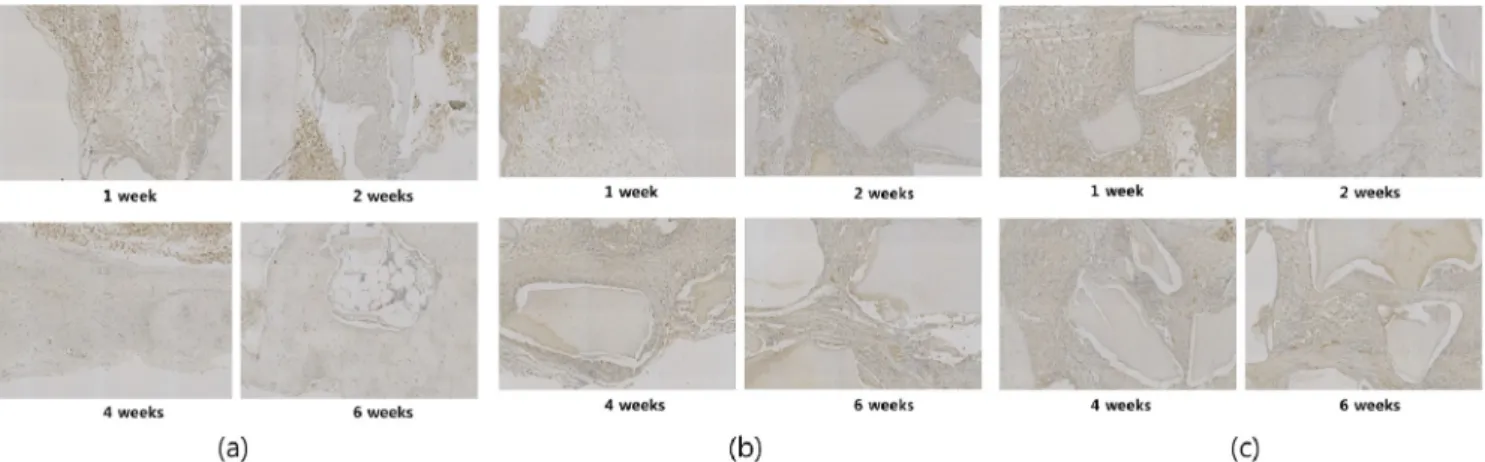 Fig. 7. Immnohistochemistry analysis for osteocalcin. (a) control group that the bone defect was not treated with anything, (b)  experimental group A that autogenous demineralized dentin matrix was grafted into the bone defect, (c) experimental group B tha