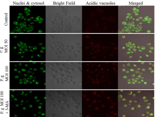 Fig 2. Visulization of intracellular autophagic vacuoles in THP-1-derived macrophages