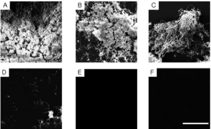 Fig. 3. Scanning electron microscopy of S. mutans biofilms  grown in propolis. A) Control (B) 0.025 mg/ml (C) 0.05 mg/ml  (D) 0.1 mg/ml (E) 0.2 mg/ml (F) Positive control (0.1% NaF),  Bar= 50 um