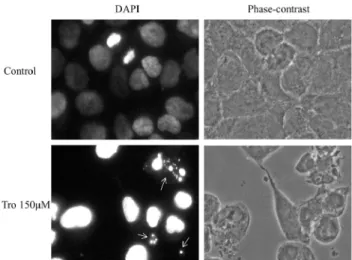 Fig. 1. Effect of TRO on YD15 cell viability. Cells were  treated with indicated concentration of TRO for 24 h