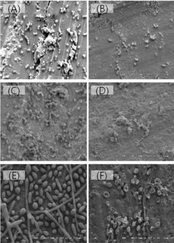Fig. 8. The photographs of scanning electron microscope. The  form of bacteria was distorted after palsma treatment for 5 min