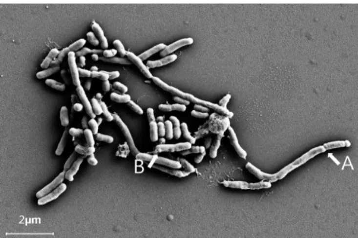 Fig 3.  A. actinomycetemcomitans ATCC 33384 exposed to  sub-MIC penicillin. Filaments with blebs were observed