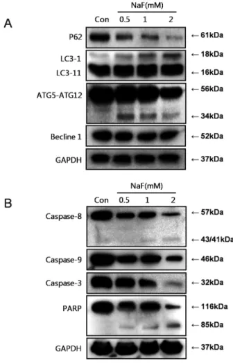 Fig. 3. NaF showed induction of autophagy in SCC25 cells. 