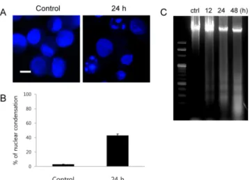 Fig. 5. Curcumin induced activation of CAD and ICAD. (A)  Western blot analysis showed the activation of DFF45/ICAD  after treatment of 25 μM curcumin