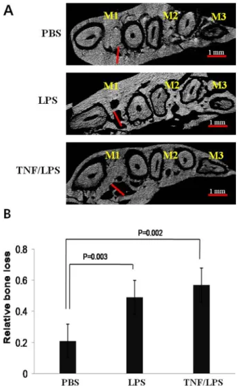 Fig. 3. Effects of LPS and TNF/LPS on the interdental alveolar  process space. The 2D displayed the length of the alveolar  process space loss at PBS, LPS and TNF/LPS mice (A)