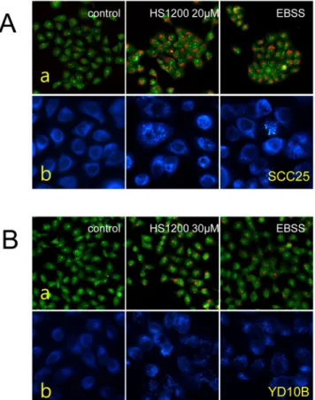 Fig. 2. HS-1200 induced autophagy in OSCC cells. Cells were  stained with acridine orange (A-a, B-a) and MDC (A-b, B-b)  as described in Materials and Methods