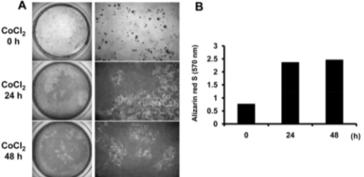 Fig. 6. Alizarin red S staining results after temporary exposure of  CoCl 2  on hTERT-hfMSCs
