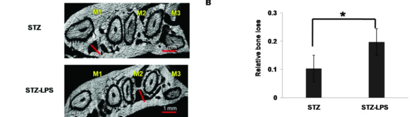 Fig. 4. The 2D representative specimens displayed interdental alveolar process space. The 2D displayed in length of alveolar process  space loss at STZ group and STZ-LPS group (A)