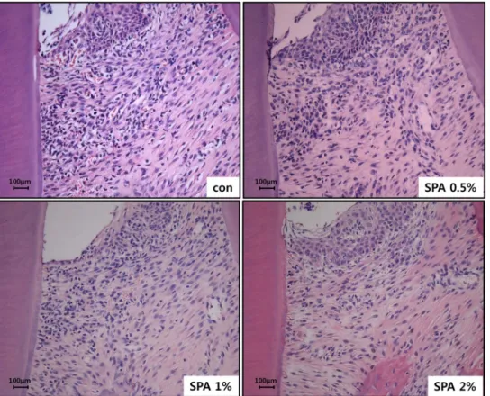 Fig. 2. Infiltration of inflammatory cells in distal area of ligatured first molar in rats