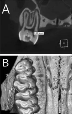 Fig. 1. MicroCT image of rat molar teeth. A. Distance from enamel surface to pulp on palatal side was about 0.3 mm