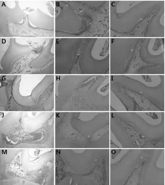 Fig. 2. Microscopic images of direct pulp capping with no material (A, D, G, J, M), calcium hydroxide (B, E, H, K, N) and MTA (C, F, I, L, O)