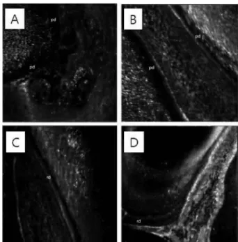 Fig. 4. Immunostaining of DSP protein after pulp capping with MTA. A, 12 hours: DSP is not immunostained in odontoblastic layer under predentin