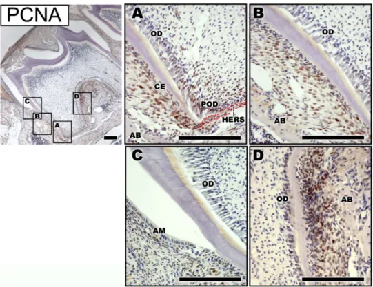 Fig. 3. Localization of Runx2 in the first mandibular molar of PN14. (A) Intense immunoreactivity of Runx2 was observed in the dental mesenchymal cells adjacent to HERS in apical region