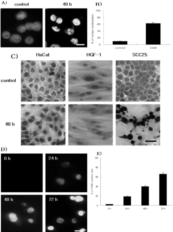 Fig. 2. Demonstration of apoptosis in SCC25 cells treated with 50 µg/ml CGM. (A) Immunofluorescent micrographs after Hoechst staining.